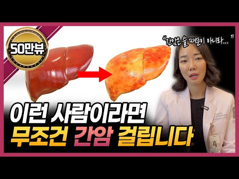 전문의가 알려드립니다 "이런 사람들이 간암 잘 생깁니다! 조심하세요!" | 간암, 지방간, 간경화