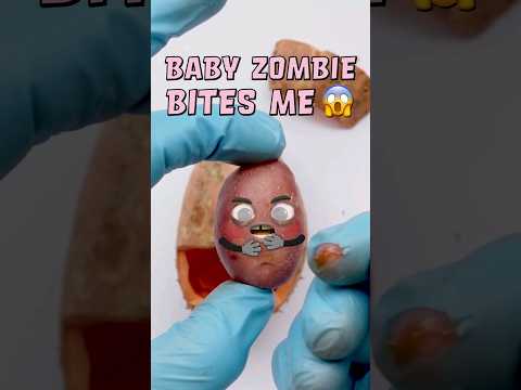 BABY ZOMBIE BITES ME💀🥔 - Potato C-section gone wrong!😱 #foodsurgery #halloween #shorts