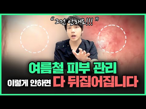 여름철 피부 관리법 7가지 | "날씨 더워지면 저는 무조건 이렇게 합니다..."