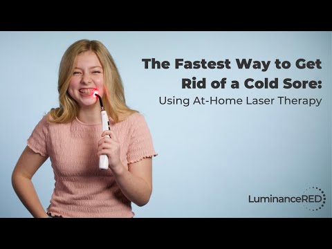 The Fastest Way to Get Rid of a Cold Sore: Using At-Home Laser Therapy