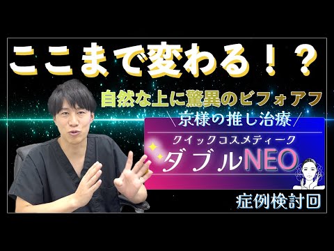 【症例検討回⑦】驚異のビフォアフ！？京様の推し治療！！クイックコスメティーク・ダブルNEO