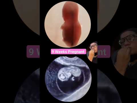 9 weeks pregnant baby playing inside Womb #babyultrasound #babyultrasound