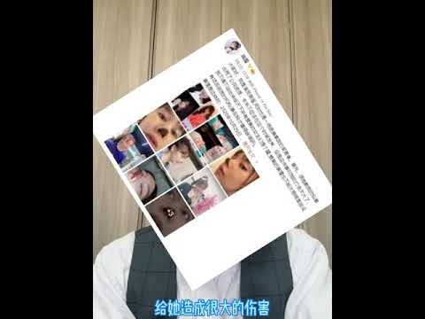 日本资深医美翻译“杨迪”vlog 医美避雷～为什么不推荐做线雕隆鼻？