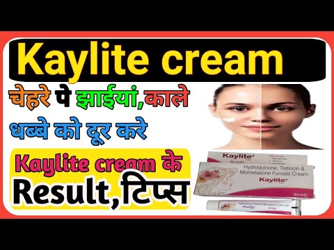 Kaylite Cream की खाश टिप्स, Result l Special tips kaylite cream, #cngajbhiye #kaylitecream