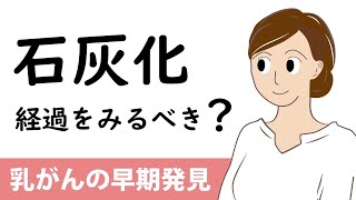 乳癌の早期発見　石灰化は経過を見るべき？