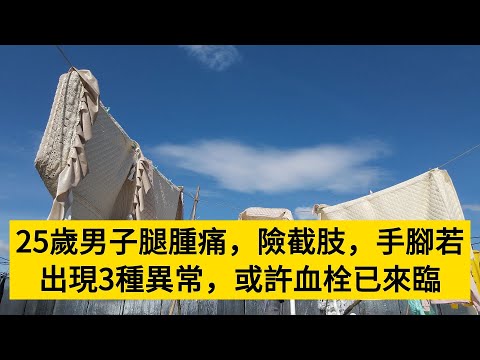 25歲男子腿腫痛，險截肢，手腳若出現3種異常，或許血栓已來臨#養老#晚年幸福#中老年心語#情感故事