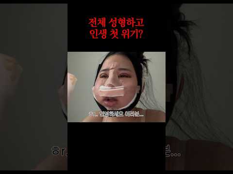 전체 성형하고 겪은 첫 위기 #shorts