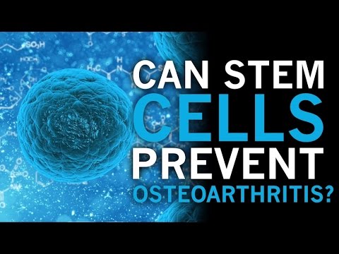 Can Stem Cells Prevent Osteoarthritis?