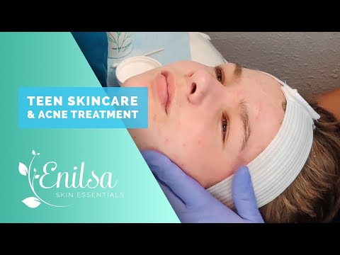 Teen Skincare & Acne Treatment (Educational Video)