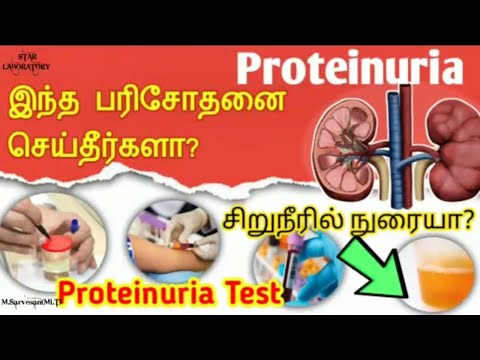 Proteinuria treatment in Tamil/foamy reason in tamil/kidney pain location on body in tamil/urinetest