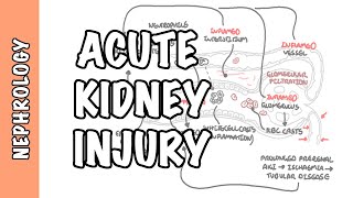 Acute Kidney Injury (AKI) - prerenal, intrarenal and postrenal causes and pathophysiology