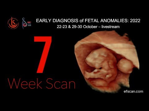 7 Week Scan in Fetal Medicine: Early Fetal Scan Conference 2022