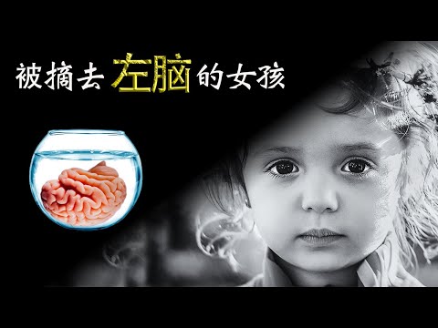 为何父母狠心同意 冒着失去说话功能的风险 大脑手术的奇迹 ｜ 奇闻 迷案 王魄 心理学