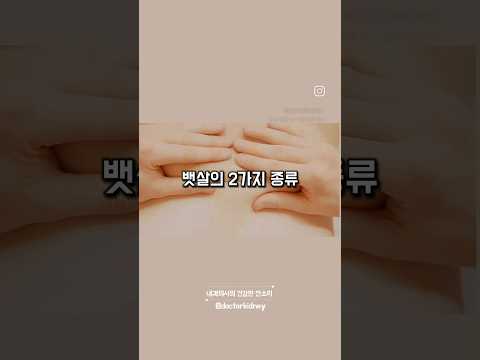 뱃살 2가지 종류 구분하는 방법 #건강습관 #뱃살관리 #뱃살