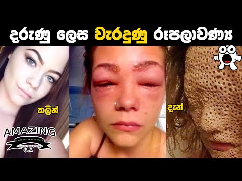 දරුණු ලෙස වැරදුණු රූපලාවන්‍ය සත්කාර Cases Of Beauty Treatments Gone Wrong Abirahas Gaweshanaya