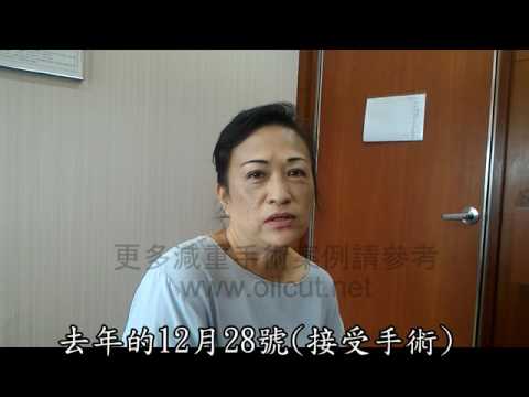 20170723 90公斤糖尿病術友術後半年見證糖尿病改善