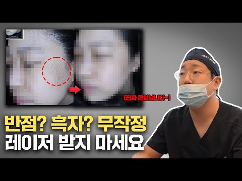 무작정 레이저 치료 받고 색소침착이 더욱 심해지는 이유 / 군집성 흑자, 반점, 오타모반