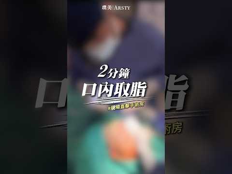 手術直擊！口內取脂竟只要2分鐘?!瘦小臉的加分術式 #嘴邊肉 #嬰兒肥 #脂肪墊 #荊偉政醫師