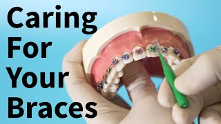 Caring For Your Braces | Dental