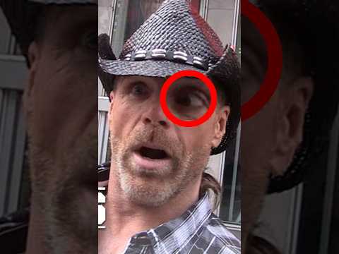 What's Wrong With Shawn Michaels Eye? 😂😂