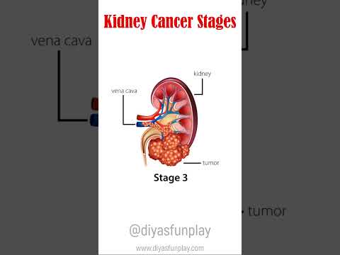 kidney cancer stages - health awareness video by diyas funplay - #shorts