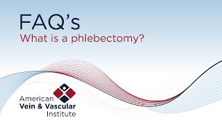 What is a phlebectomy? - American Vein & Vascular Institute