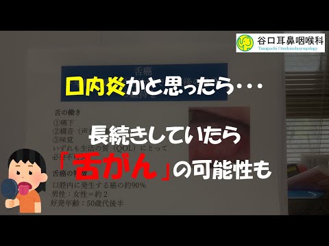 【現役医師が教える！】舌の違和感が続いたら・・・？【舌癌】