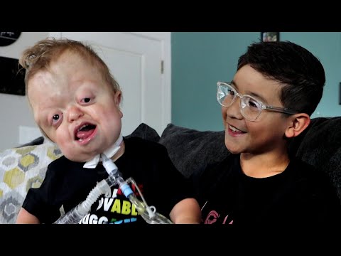 Raedyn's Unique and Fun Life (Pfeiffer Syndrome)