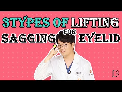 3types of lifting method for sagging eyelid / blepharoplasty, subbrow, forehead lifting / Anti-aging