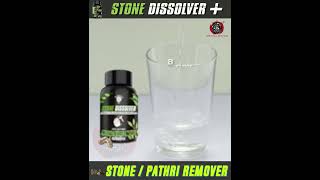 Best Ayurvedic solution to Unbearable kidney pain | Stone Dissolver+ | THE YOGA MAN LAB