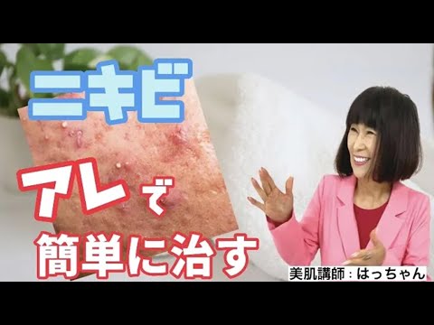 肌荒れニキビは簡単に治る！美肌の作り方を教えます♪♬