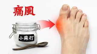 痛風最佳自然療法:小蘇打粉或電解質粉,柏格醫生 Dr Berg