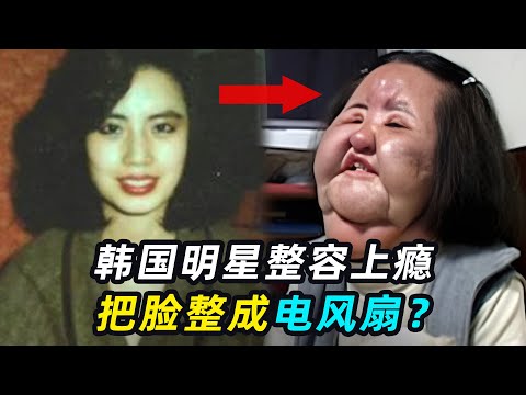 韩国女明星整容上瘾，脸部注射食用油，最后整成“电风扇”