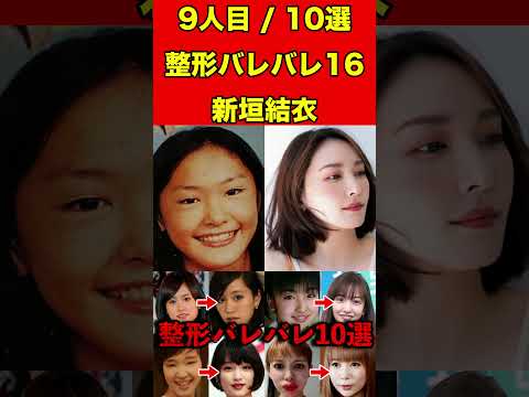 新垣結衣16整形がバレバレな芸能人！10選 #芸能界の闇 #ゴシップ #整形 #芸能人 #噂話 #有名人  #雑学 #モデル #芸能 #女優 #アイドル #美容