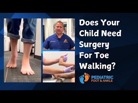 Does Your Child Need Surgery for Toe Walking? Dr. Jarman Explains