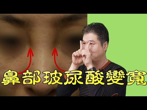 玻尿酸隆鼻副作用中鼻樑變寬的原因和解決方法