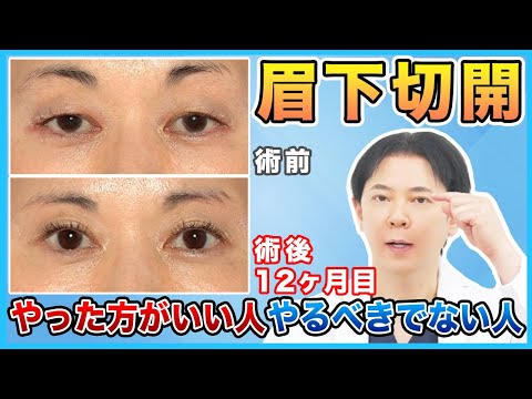 【目の上のたるみ】眉下切開法を受けるにあたり注意すべき人の特徴