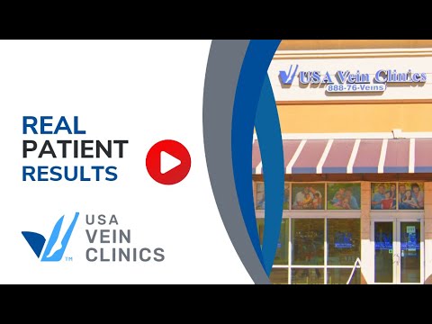 USA Vein Clinics Review from Happy Patient.