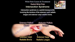 Wrist Pain Causes & Treatment  - Everything You Need To Know - Dr. Nabil Ebraheim