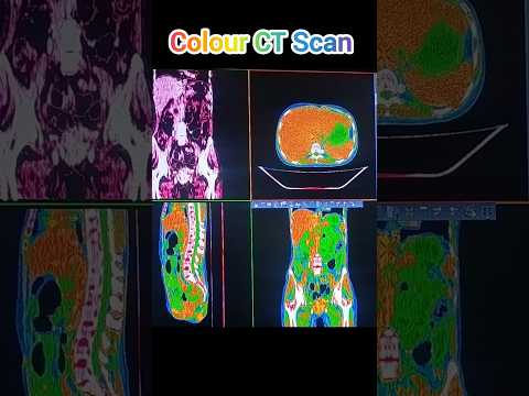 Colour CT Scan