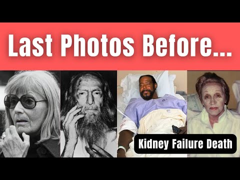 Celebrity Deaths from kidney failure