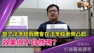 假體法令紋的迷思（Part 1）墊了法令紋假體會在法令紋兩側凸起，效果很不自然嗎？打破醫美謬思 74-20180214