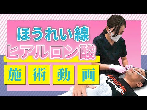 【気になる法令線をヒアルロン酸で改善！】注入治療の施術風景を大公開します！【額ボトックス注射】