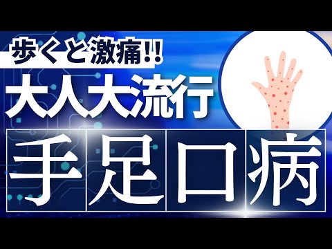 大人も激痛で歩けない！手足口病が過去最悪ペースで大流行中！徹底対策を解説