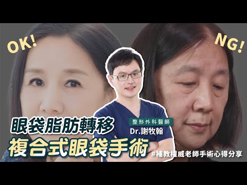 眼袋脂肪轉移複合式眼袋手術改善補教權威老師眼袋問題手術心得分享