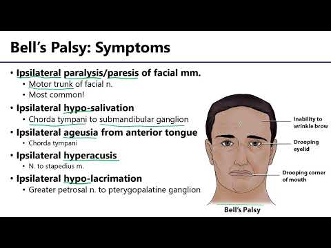 LO7 Facial Nerve Bells Palsy