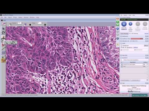 Medical School Pathology, 2013 Season, Session #43: Skin-CNS-Ortho-Lab-I