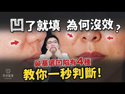 忽略這點，法令紋治療就無效！鼻基底凹？不是每個人都適合貴族手術！教你居家檢測自己是哪種法令紋？｜依心唯美 李京軒醫師