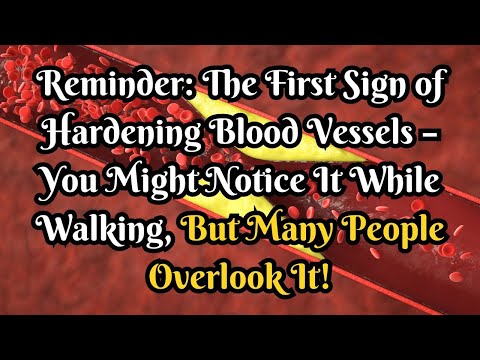 Reminder: The First Sign of Hardening Blood Vessels – You Might Notice It While Walking!