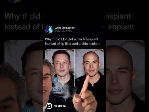 Elon Musk Plastic Surgery??? #fillers #implants